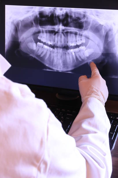 Best Emergency Root Canal Treatment in Moodys, OK